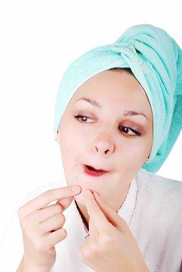Adult Acne: Reasons why do you get it and ways to treat it